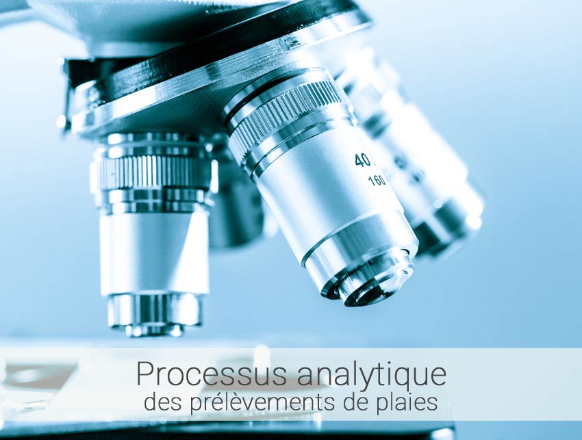 processus-analytique processus-analytique