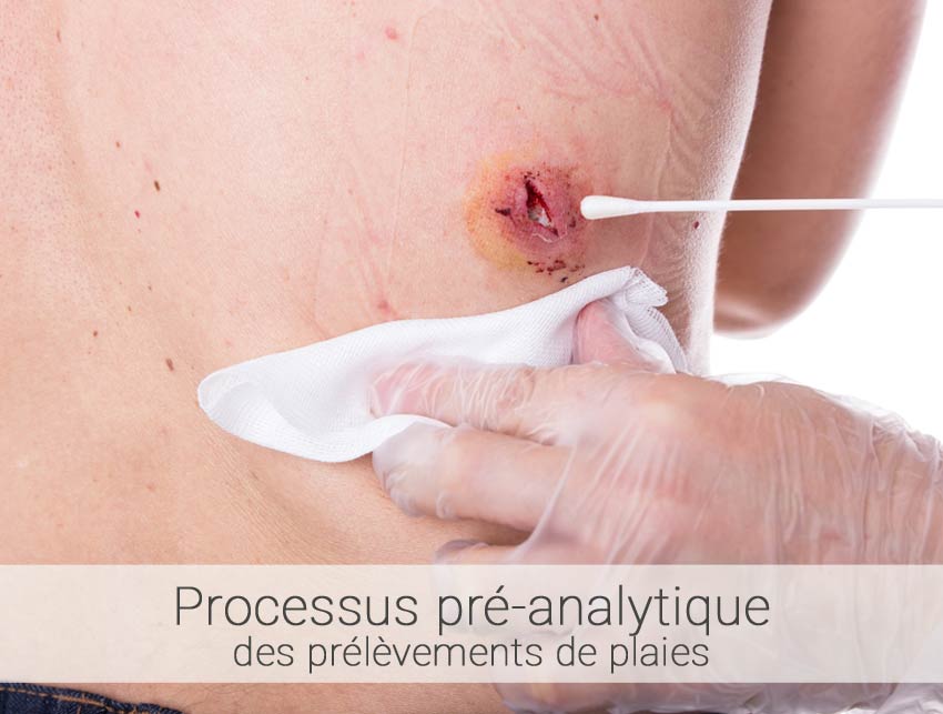 processus-pre-analytique processus-pre-analytique