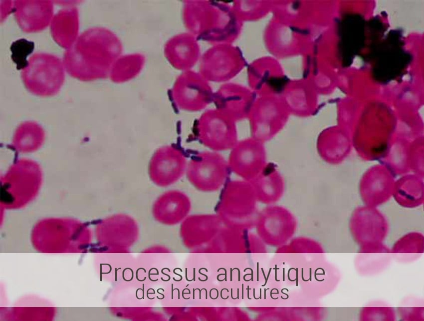 processus-analytique-des-hémocultures processus analytique des hemocultures