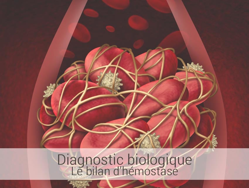 le-bilan-d'émostase le bilan d'hémostase