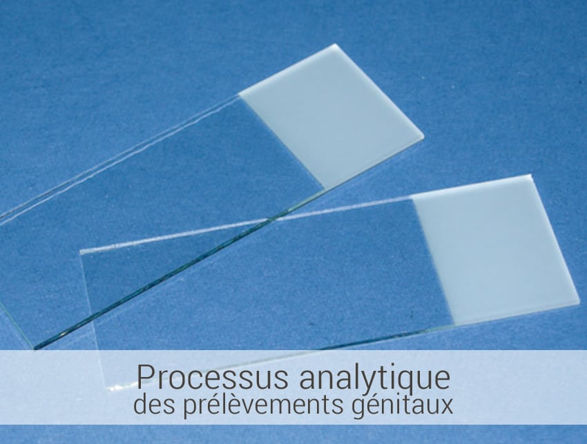 processus-analytique-des-prelevements-genitaux prélèvements génitaux