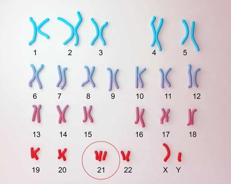 Place des tests ADN libre circulant dans le sang maternel dans le dépistage de la trisomie 21 foetale