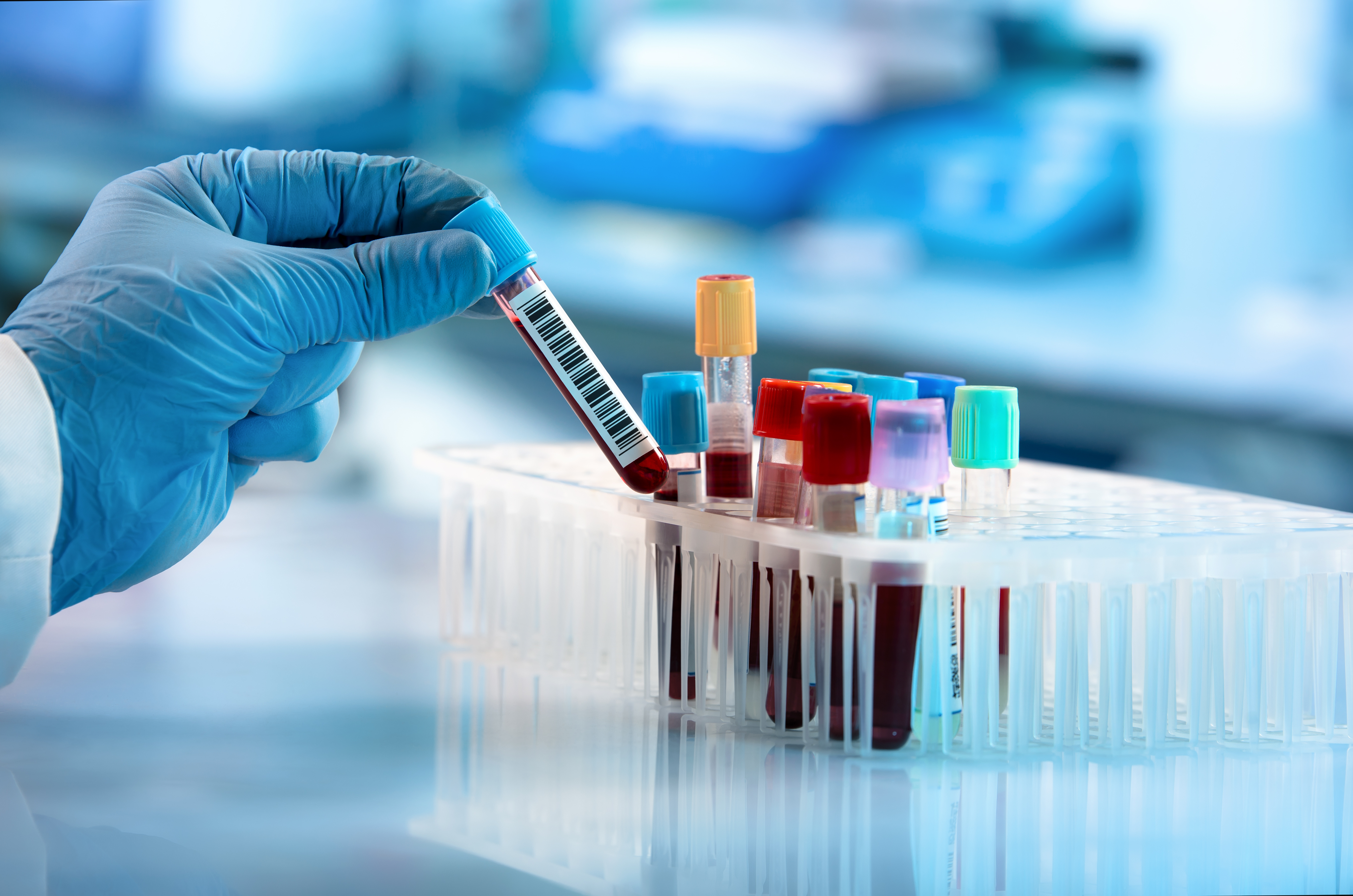 Formation maîtriser les risques de la phase pré-analytique des prélèvements