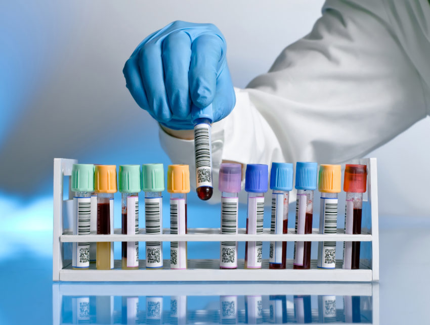 hand drawing a tube A laboratory technician removing a tube rack with a blood sample labeled with bar codes, on a blue background