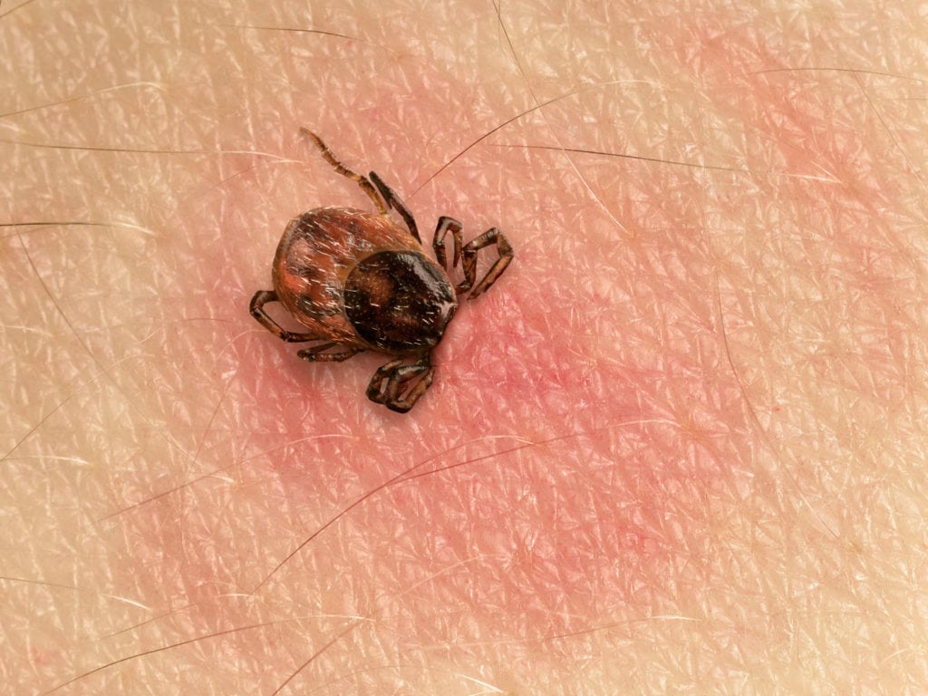 Stratégie diagnostique de la maladie de Lyme