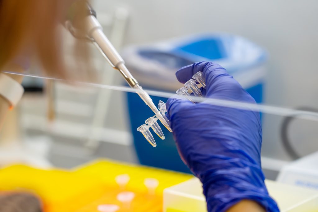 Le diagnostic biologique du Mpox repose sur des techniques avancées comme la PCR, essentielles pour une détection précoce et précise du virus. Cet article explore l'importance cruciale de ces tests dans la lutte contre la propagation de l'épidémie.