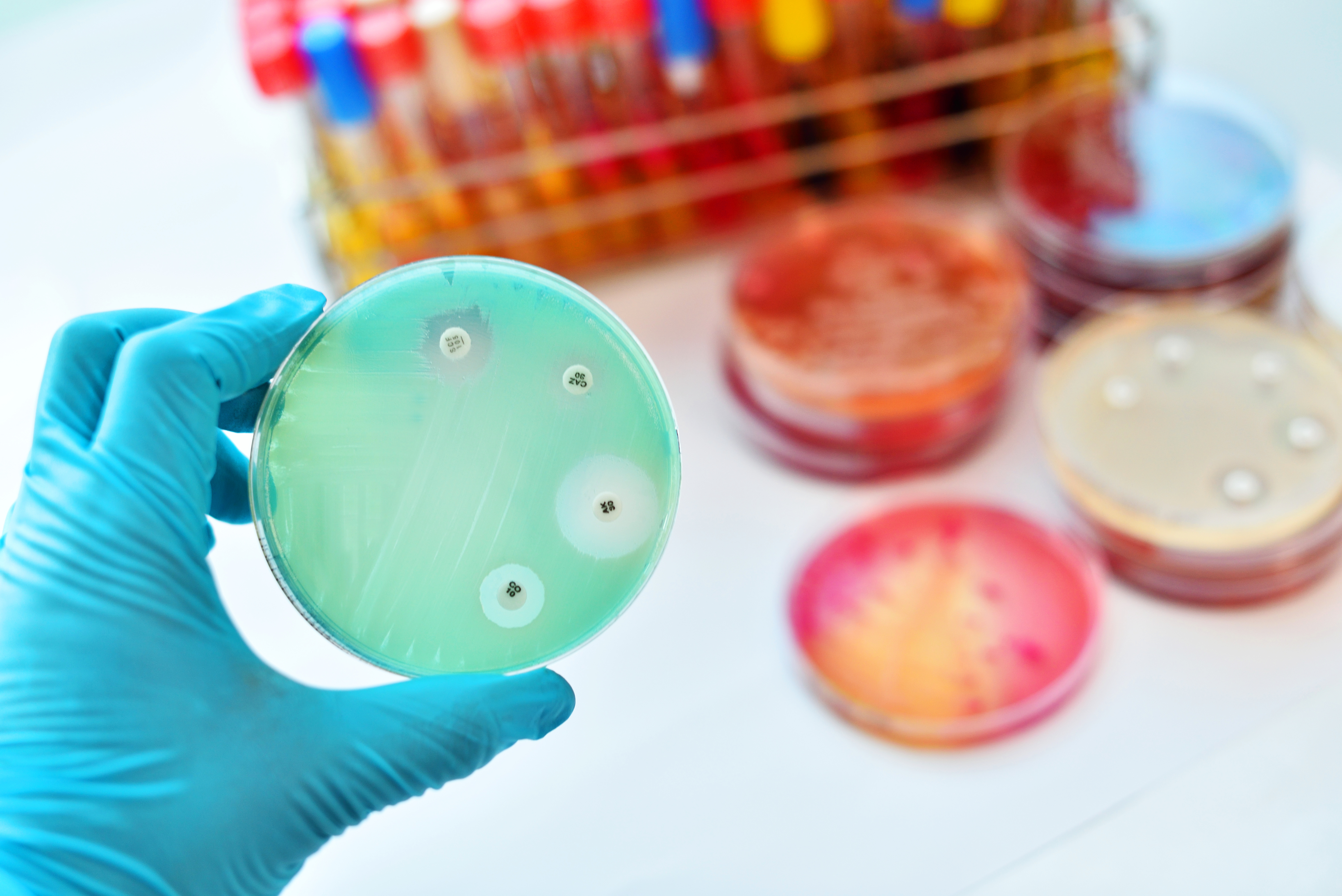 Formation interpréter les antibiogrammes selon les nouvelles recommandations